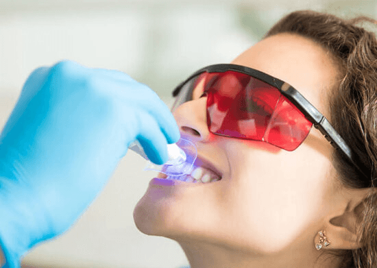 Klinik tipi ışıklı diş beyazlatma